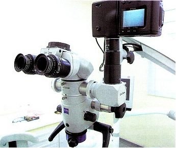 Tratamento de Canal com Microscópio em Belo Horizonte