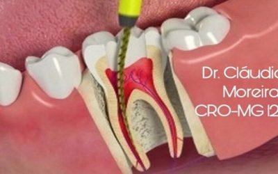 O que é endodontia?