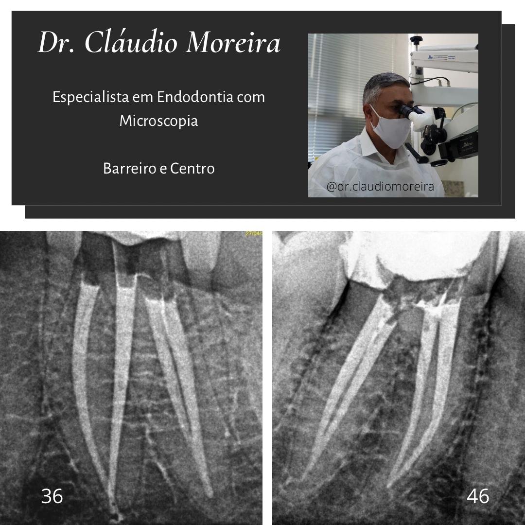ECM-Imagem-01